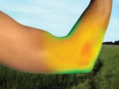 BACK ON TRACK BOT LL Back on Track® Elbow Brace- Braces